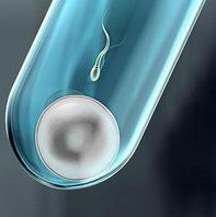 在二连浩特市做试管婴儿长方案周期需要多久？超长方案促排流程是怎么样的？