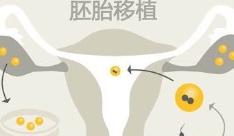 赴泰国做试管婴儿出国前需要做准备什么？